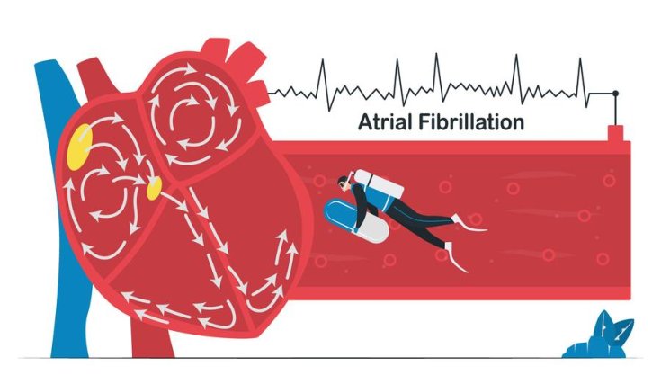 What Is Atrial Fibrillation? Is It Dangerous?